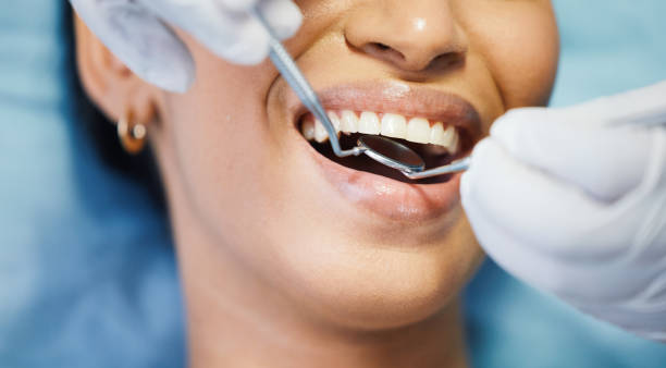 Best Emergency Denture Repair in Chillicothe, MO